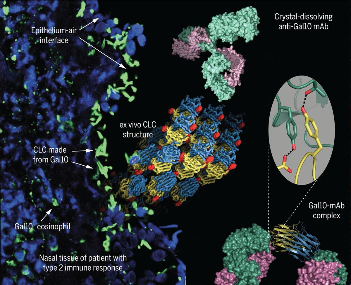 mmw_lmw's tweet photo. #ProteinCrystallization promotes #Type_2_Immunity | Galectin 10 based crystals can be dissolved by specific Antibodies | with relevance to Asthma and Allergy | Bart Lambrecht @InflamResCen @sciencemagazine https://t.co/9tBtP3jSgG | #May_ReCap https://t.co/ZWHtEuc78A