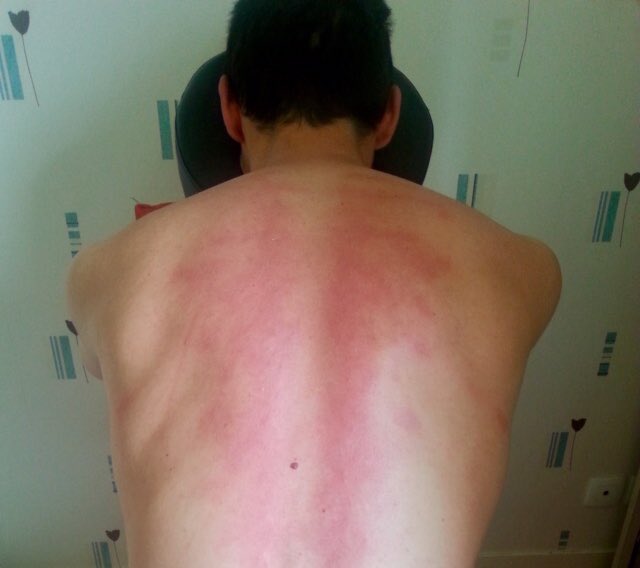 ronan_datausse's tweet photo. Le #massage #russe au #bâton , une méthode radicale pour #purger les #tensions du #dos . Obligé de #lacherprise pour se #détendre et accepter la #douleur . Une fois que c’est fini, c’est le #bienêtre complet.
#healthy #wellness #naturaltraining #sante https://t.co/MS7jkPxWst