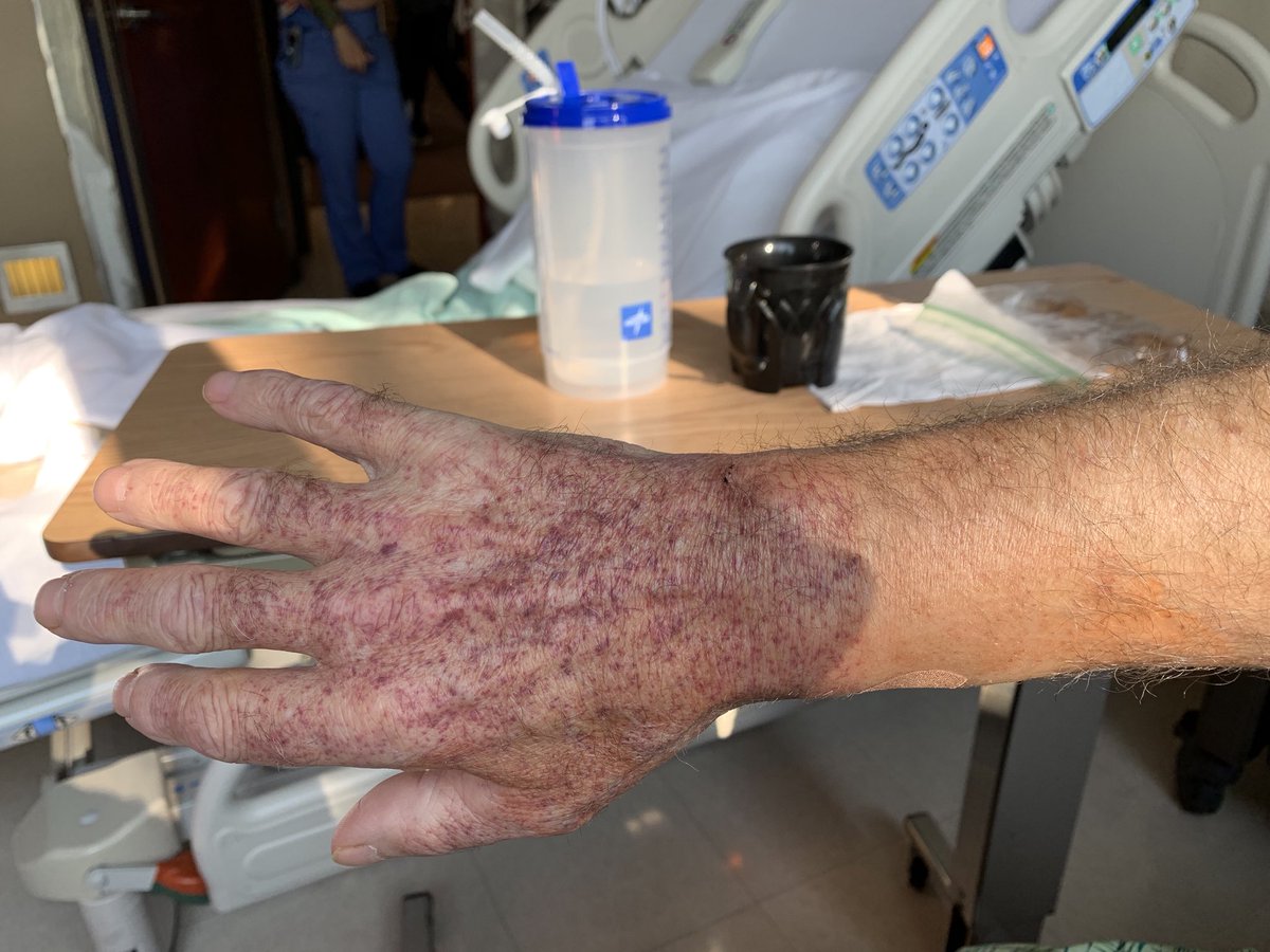 Get Radial Artery Access From Articl Net On Twitter For iPhone Free Wallpaper Radial Artery Access From Articl Net On Twitter For Free