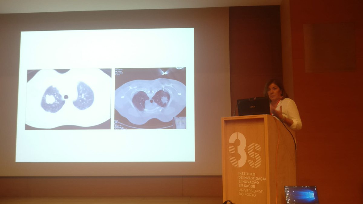 SPAPatologia's tweet photo. Segunda palestra da sessão "From bench to bedside" - Conceição de Souto Moura sobre Carcinoma pulmonar de não pequenas células. #CursoPatologiaMolecular #NISPAP #SPAP #IPATIMUP #Pathology https://t.co/9MIGGDCyRA