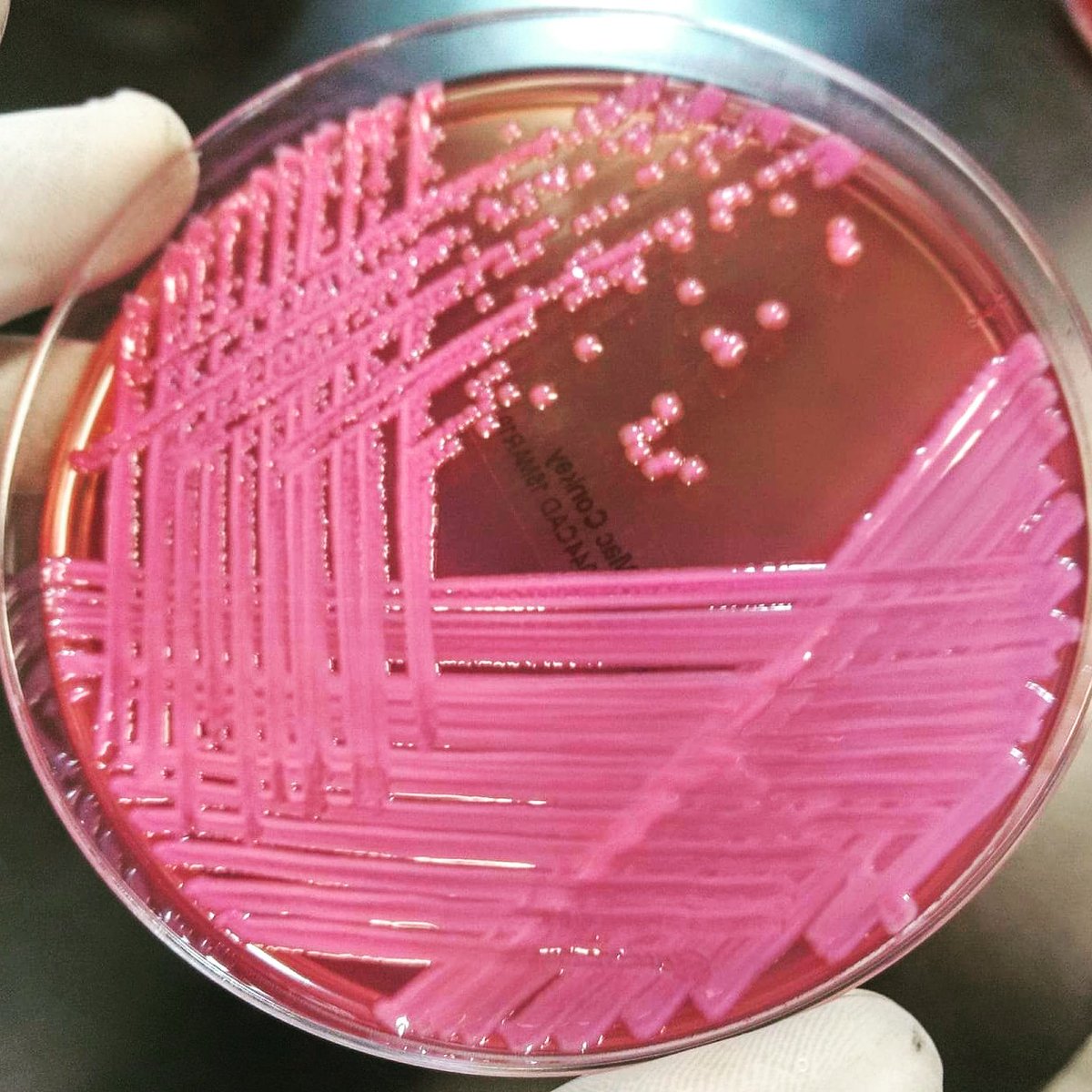 mICROBIOsh's tweet photo. Klebsiella aerogenes antes llamada Enterobacter aerogenes.
#microbiology #ASMClinMicro #microround #microbiologia https://t.co/u85hQV5Pdu