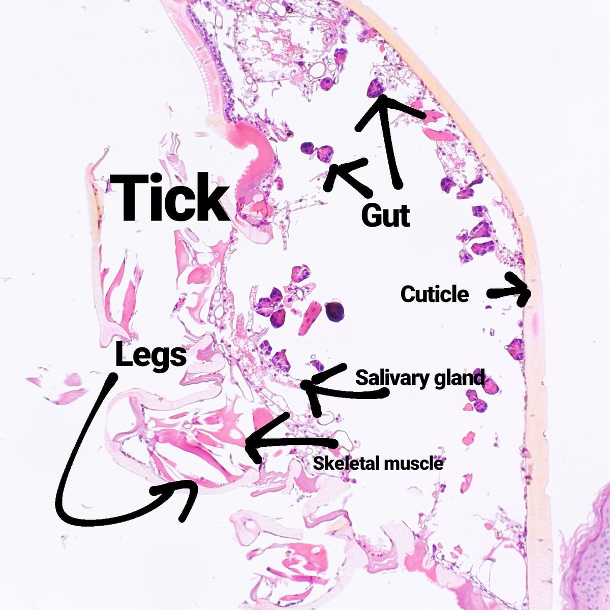Margaret_Cocks's tweet photo. Ticks under the microscope: this image is so cool that I don't think it needs any description! #pathology #dermpath #dermatology #histology #tick #skin #meded #microscope #dermatopathology #pathart https://t.co/n8vuiwGr1X