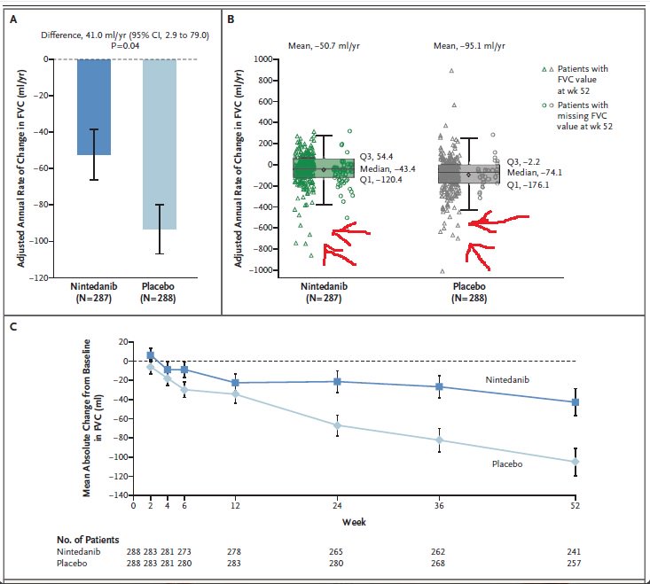 leticiakawano's tweet photo. 1/ Only now I had time to sit and read #SENSCIS results. Sharing some thoughts and I would be happy to hear how the #ILD #Medtwitter community felt about it:
@NEJM @sclerodermaUM @RheumILD @PhilippeDieude @jeffsparks @GarchaMed @KerriBerriKerri @IPFdoc @davidlederer @KaminskiMed https://t.co/71YvYzPGYz