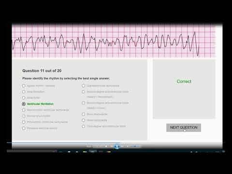 New post (ACLS Rhythm Recognition Review) has been published on Nurseboards - nurseboards.com/groups/nursing…