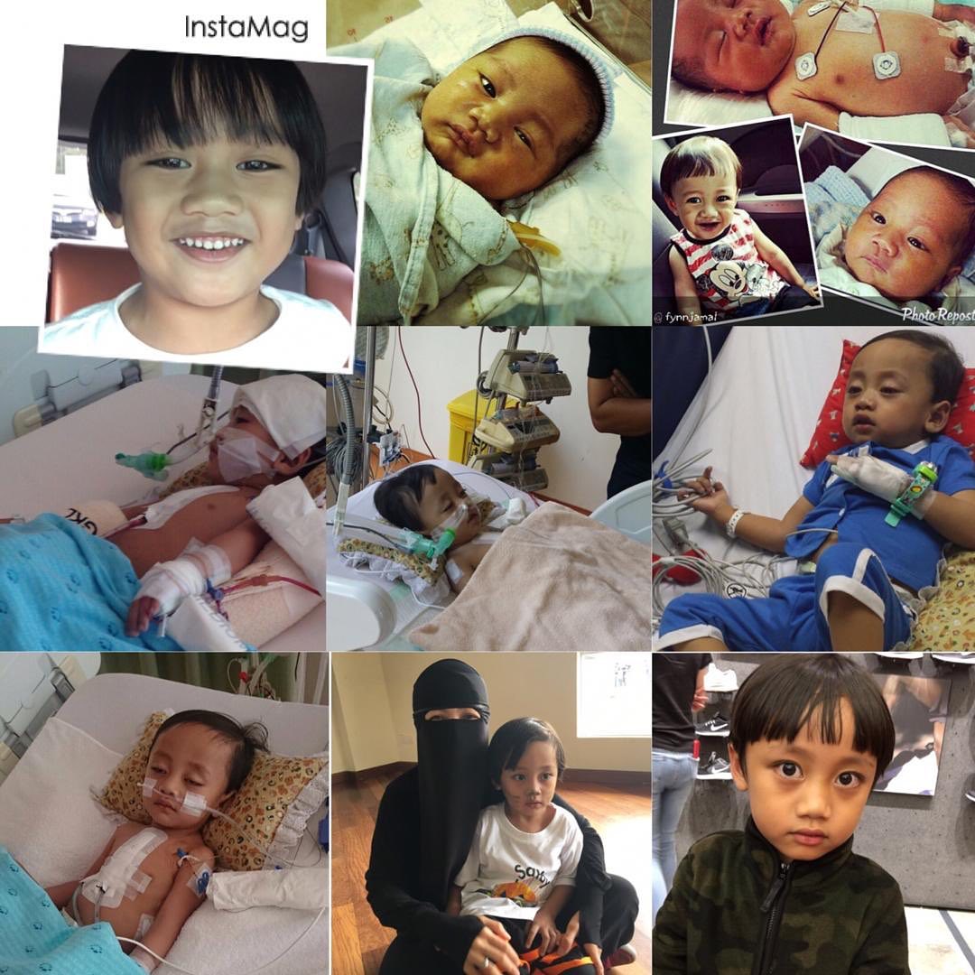 Afinasyahmah On Twitter I Got This From Fynn Jamal S Ig You May Check There For Confirmation Please Twitter Do Your Thing This Little Boy Needs Our Help A Rt Would Be Enough Aimanpsikologi Aimanazlan90 Ketengahketepi Puneirejang Azfarovski