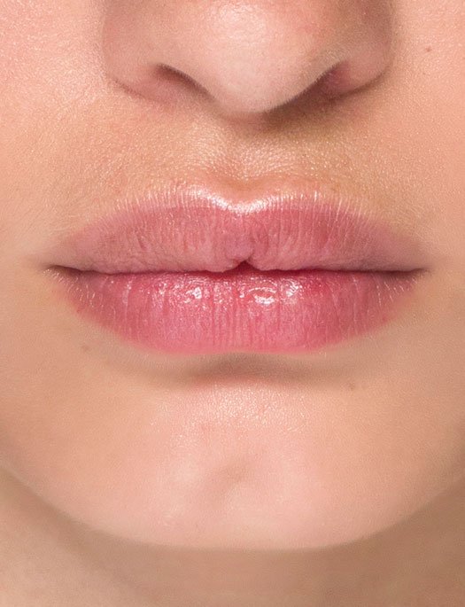 marieclaire_es's tweet image. ¿Bruxismo? Existe una nueva solución que te evitará llevar #férula al dormir. Porque, ¿sabías que casi el 80% de la población general es #bruxista?
bit.ly/2wc8lr6