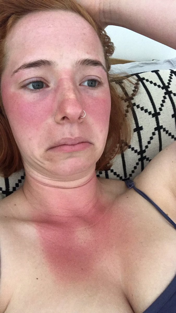 JNewsomestone's tweet photo. So this happened. If anyone needs me I’ll be hiding from the sun 🐼 https://t.co/BEhQ9pIiil