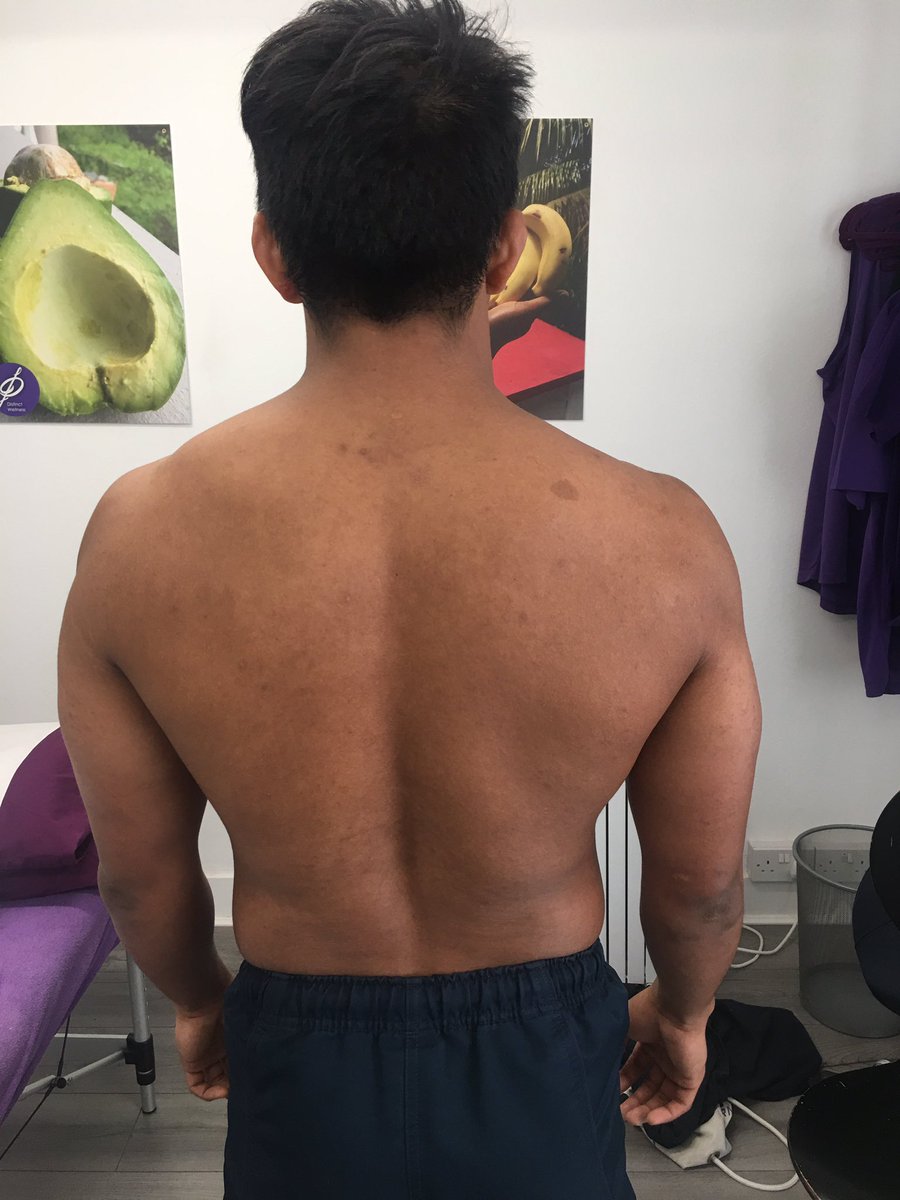 distinctphysio's tweet photo. That pain in your neck will linger when you don’t address the root cause of the actual problem or you don’t rehabilitate the right muscles! #explainpain #neckpain #neckandshoulder #muscles #joints #nerves #rehabilitation #physio #headache #jointrestrictions https://t.co/HO8fKzV20Z