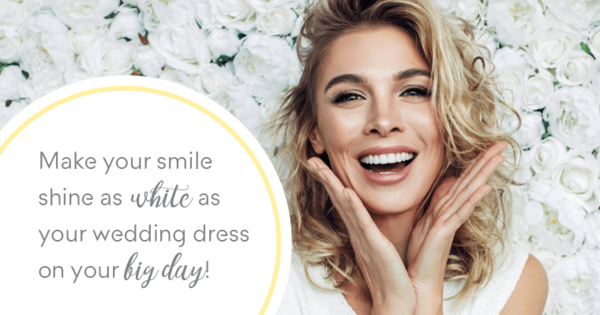 Wedding Planning - Getting Your Smile Ready for the Big Day upflow.co/l/dfZ6