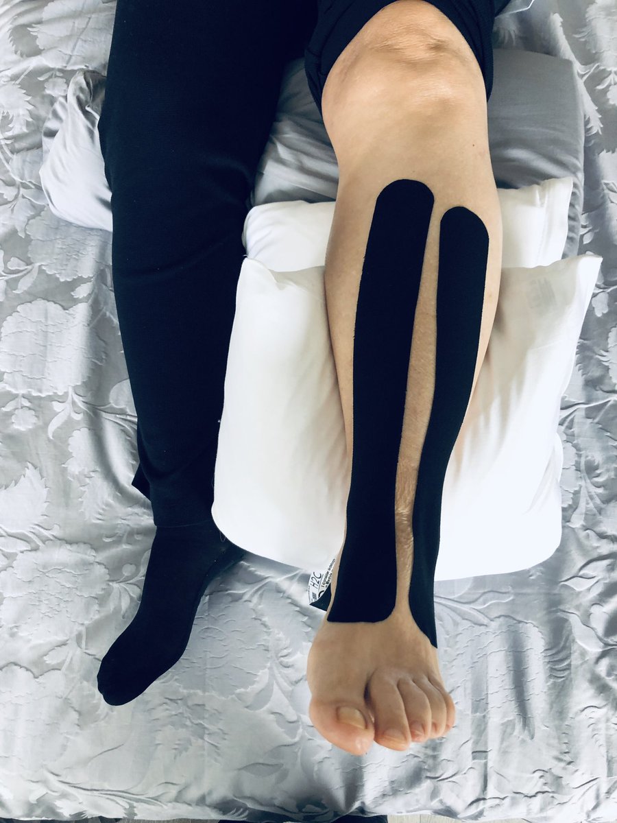 robvanlook's tweet image. Das erste 72h Stunden #tape meiner neuen Kundin für Lymphfluss, Durchblutung und Unterstützung der Muskulatur. Thanks @Rocktape 

#personaltraining #rocktape #bewegung