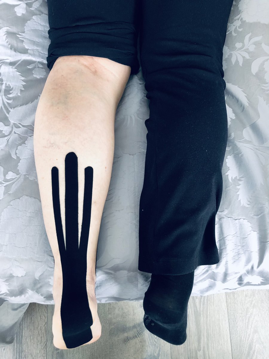 robvanlook's tweet image. Das erste 72h Stunden #tape meiner neuen Kundin für Lymphfluss, Durchblutung und Unterstützung der Muskulatur. Thanks @Rocktape 

#personaltraining #rocktape #bewegung