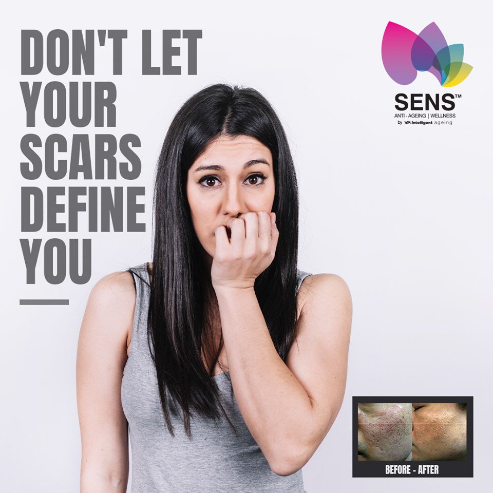 InteliAgeing's tweet photo. Forget scars, fine lines, and wrinkles for smoother, supple skin. Microneedling Radiofrequency regenerates new collagen within the dermis layer, reducing the pore size and providing a clear, healthy-looking skin. https://t.co/thRpf11pCV