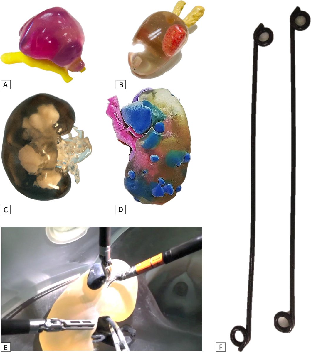 Impact of Three-dimensional Printing in #Urology: State of the Art and Future Perspectives. A Systematic Review by ESUT-YAUWP Group
@Cacciamani85 <a href="/ZhamOkhunov/">Zham Okhunov</a> <a href="/aurusdm/">Aurus Dourado Menese</a> <a href="/d_veneziano/">Domenico Veneziano, MD, PhD, FEBU</a> <a href="/evanliats/">EVANGELOS LIATSIKOS</a> <a href="/PorpigliaF/">Porpiglia Francesco</a> 
europeanurology.com/article/S0302-…
