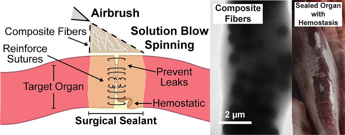 Acta Biomaterialia (@actabio) on Twitter photo Prof. Peter Kofinas: Improving the adhesion, flexibility, and hemostatic efficacy of a sprayable polymer blend surgical sealant by incorporating silica particles <a href="/zebioengr/">Leopoldo Torres</a> @ChBE_UMD <a href="/UMDBIOE/">UMD Bioengineering</a> <a href="/childrenshealth/">Children's Health</a> @MaterialsUM sciencedirect.com/science/articl… Prof. Peter Kofinas: Improving the adhesion, flexibility, and hemostatic efficacy of a sprayable polymer blend surgical sealant by incorporating silica particles <a href="/zebioengr/">Leopoldo Torres</a> @ChBE_UMD <a href="/UMDBIOE/">UMD Bioengineering</a> <a href="/childrenshealth/">Children's Health</a> @MaterialsUM sciencedirect.com/science/articl…