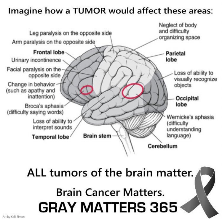 When someone gets #cancer, the whole family is affected. Do something nice for the caregiver of a friend with cancer #BrainTumorAwarenessMonth #GoGrayinMay #31DaysofGray #BTSM 🧠