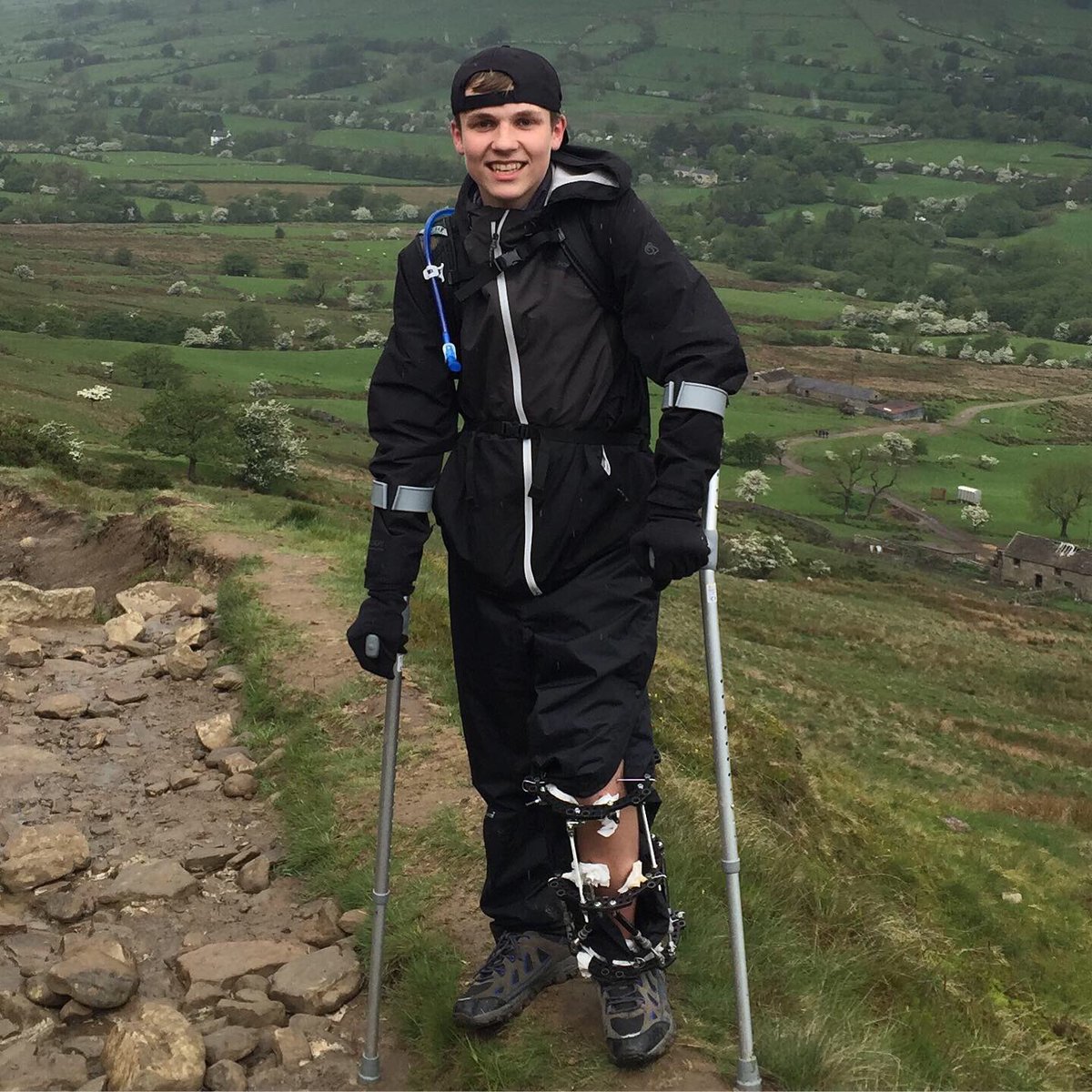 pitstopdotp's tweet image. Duke of Edinburgh Silver Expedition smashed this weekend with an external fixator on! You rock Jack.💪🏻 @silcoatesschool @SilcoatesSport @DofE