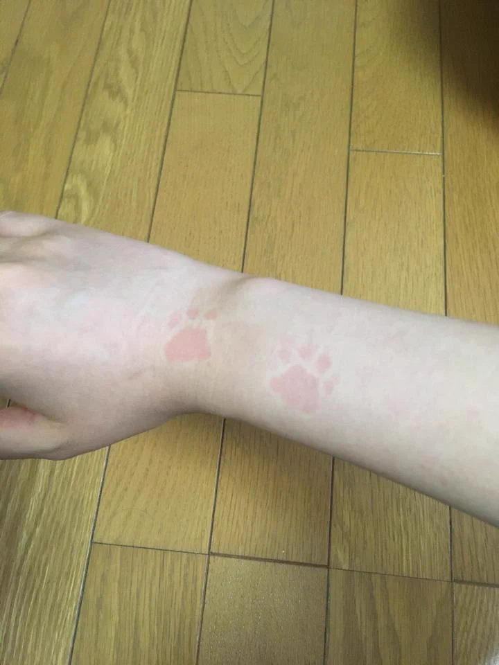猫が腕に乗った跡がｗｗｗ本当にこんな風になるなんてｗｗｗ