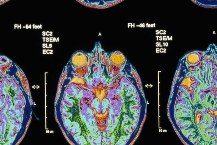 servantofchaos's tweet image. An X-ray was once between you and your doctor, but for how long? buff.ly/2McjLpk #My31 #dataasproperty