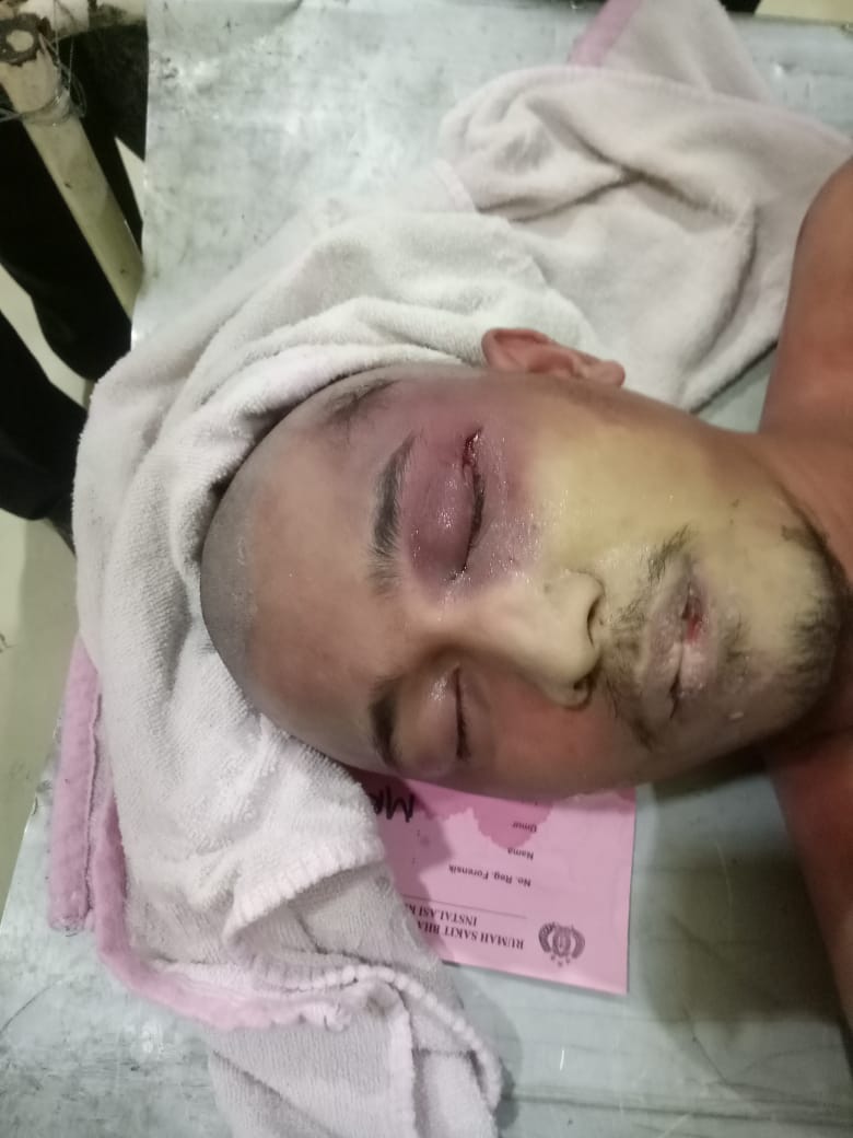 UcoxRegar2's tweet photo. Dan ditemukan tewas dengan keadaan mengenaskan..
Ada bekas penganiayaan dan bekas peluru di kepala
@prabowo https://t.co/OeXeAzNJTA