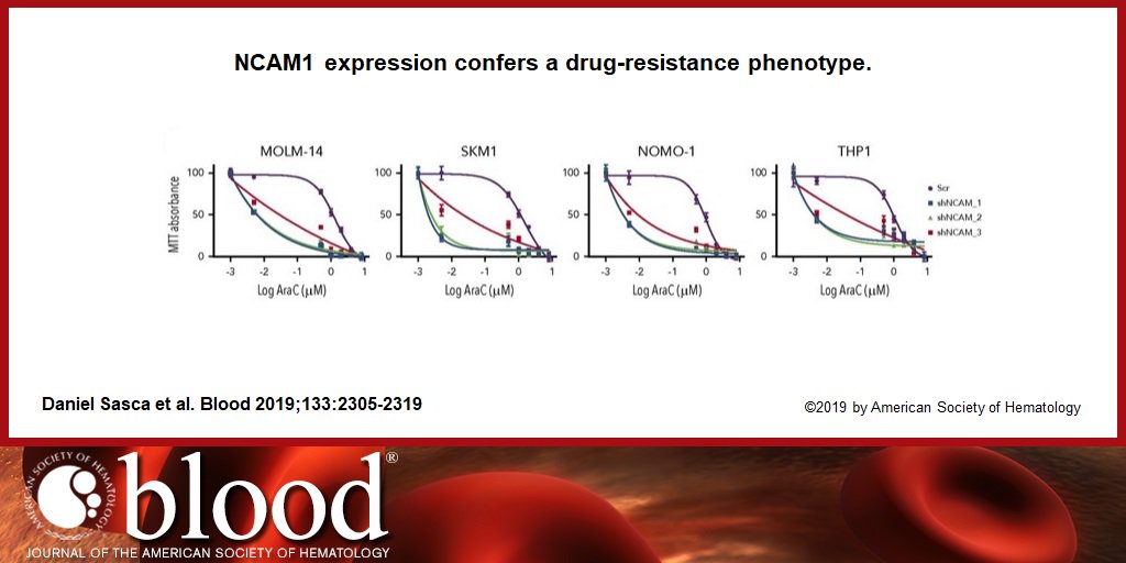 NCAM1 (CD56) promotes leukemogenesis and confers drug resistance in #AML bloodjournal.org/content/133/21…