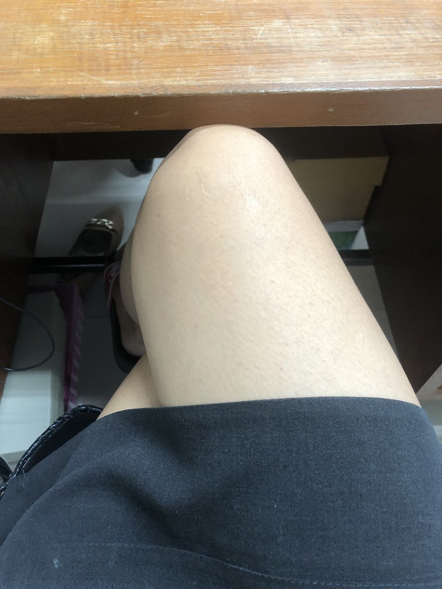 jonggy5's tweet image. ขาว ใส เนียน ดีต่อใจ #polypair #polypaircollagen