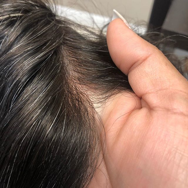 thetotalsecret's tweet photo. Nuestras prótesis capilares son básicamente un duplicado de tu cuero cabelludo...! Ven para una consulta completamente Gratis, sin riesgo, sin efectos secundarios. ——————————— Our hair system are basically a duplicate of your scalp ...! Come for a completely free consultatio… https://t.co/QjWLDNYLvW