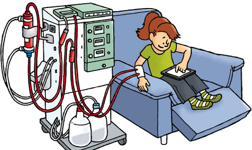 For the #CKD there are 3 treatment options: #PeritonealDialysis, #Hemodialysis and #KidneyTransplant. In #Hemodialysis, a dialysis machine and a special filter or a dialyzer, are used to clean your blood. Check with your doctor which is the better treatment for you. Info: <a href="/nkf/">National Kidney Foundation</a>