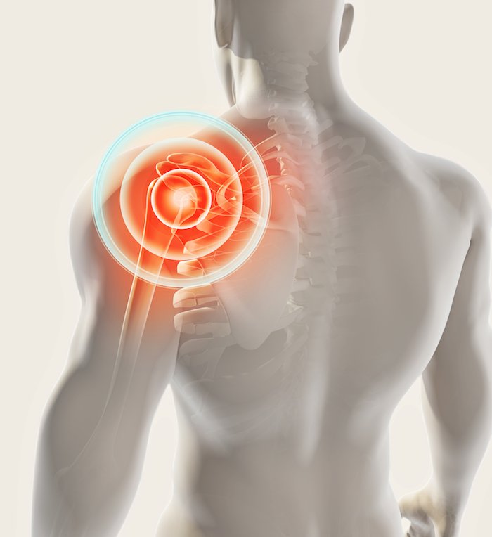 The experts at Star Orthopedics and Sports Medicine can help you explore various treatment options for rotator cuff repair. Visit our website or call 469-850-0680 to schedule an examination and consultation at our clinic in Frisco, Texas.

#rotatorcuff #shouldersurgery #FriscoTX