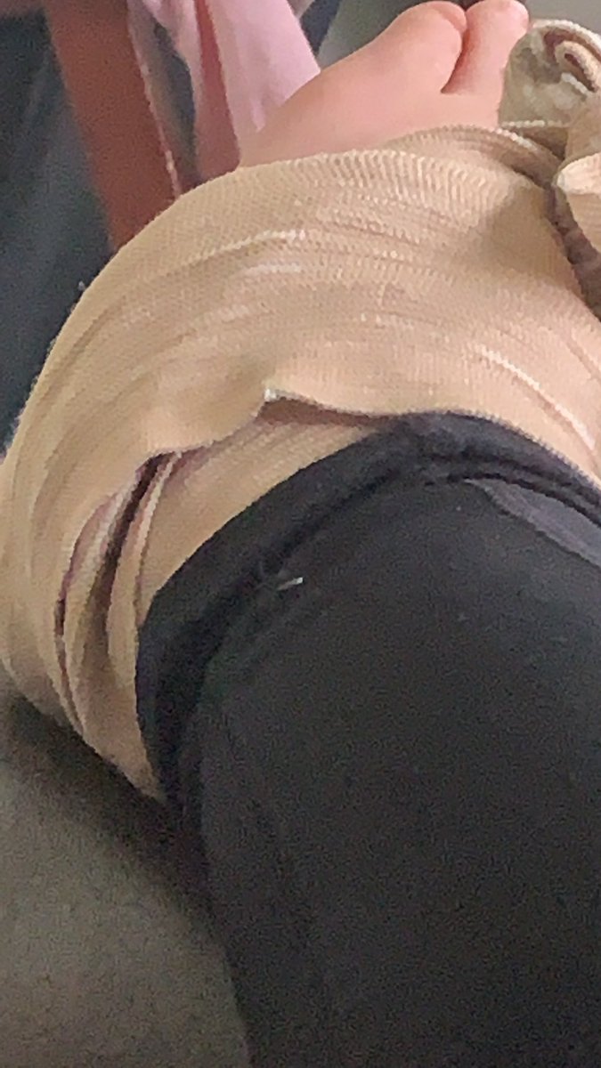 hahaahl0's tweet photo. LMAO SOOOO I kinda sprained my ankle and it kinda hurts a lot #BTSpcd #PCD @YajLala @TAESDAYDR3AM https://t.co/DelIfWycUD