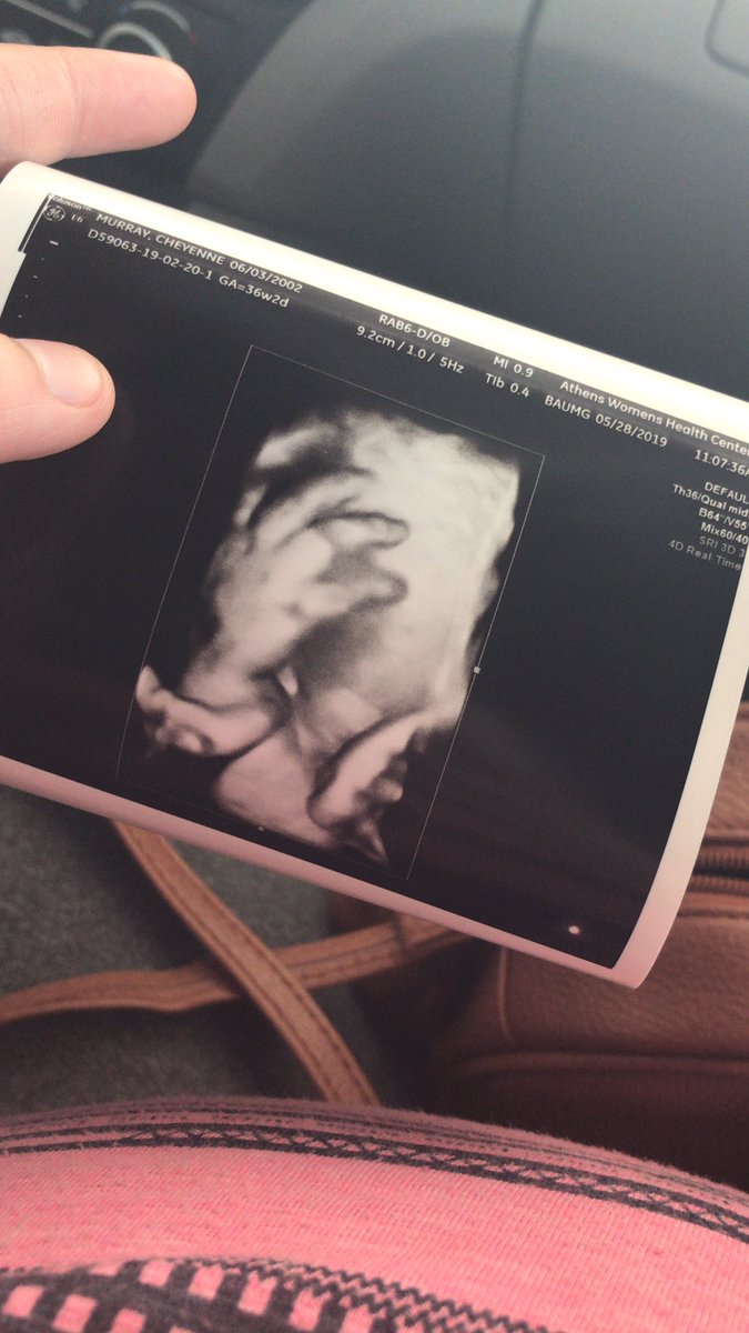 chey_babyb's tweet photo. My son decided to cover his face so mommy couldn’t see him. #LiamAllen💙 https://t.co/LVg9Vrw5Xy