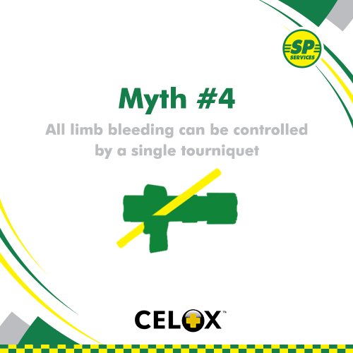 When it comes to larger thigh areas a single #tourniquet may not be enough to stop bleeding. In these cases, a second tourniquet needs to be applied above the first in order to administer the right amount of pressure to #StopTheBleed.
Continue reading 👇
spservices.co.uk/BleedingContro…