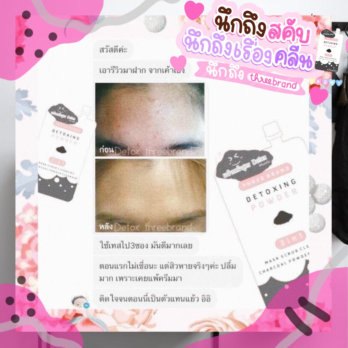 LBynana's tweet photo. ✨รีวิวเจ้าน้อนนนดีท็อกปังสู๊ดดดดด💥
สิวลดลง​ กระชับรูขุมขน​มากขึ้นนน☘️
💓ติดใจจนมาเป็นตัวแทนอ่ะคิดดูสิจ๊ะเธอออ👌🤣
#like4likes #likeforlikes #likeforlikeback #howtobeauty #ตราด #นัดรับตราด #loveskin_bynana #หน้าใสไร้สิว #ลดสิว https://t.co/OyW0oqZQ4l
