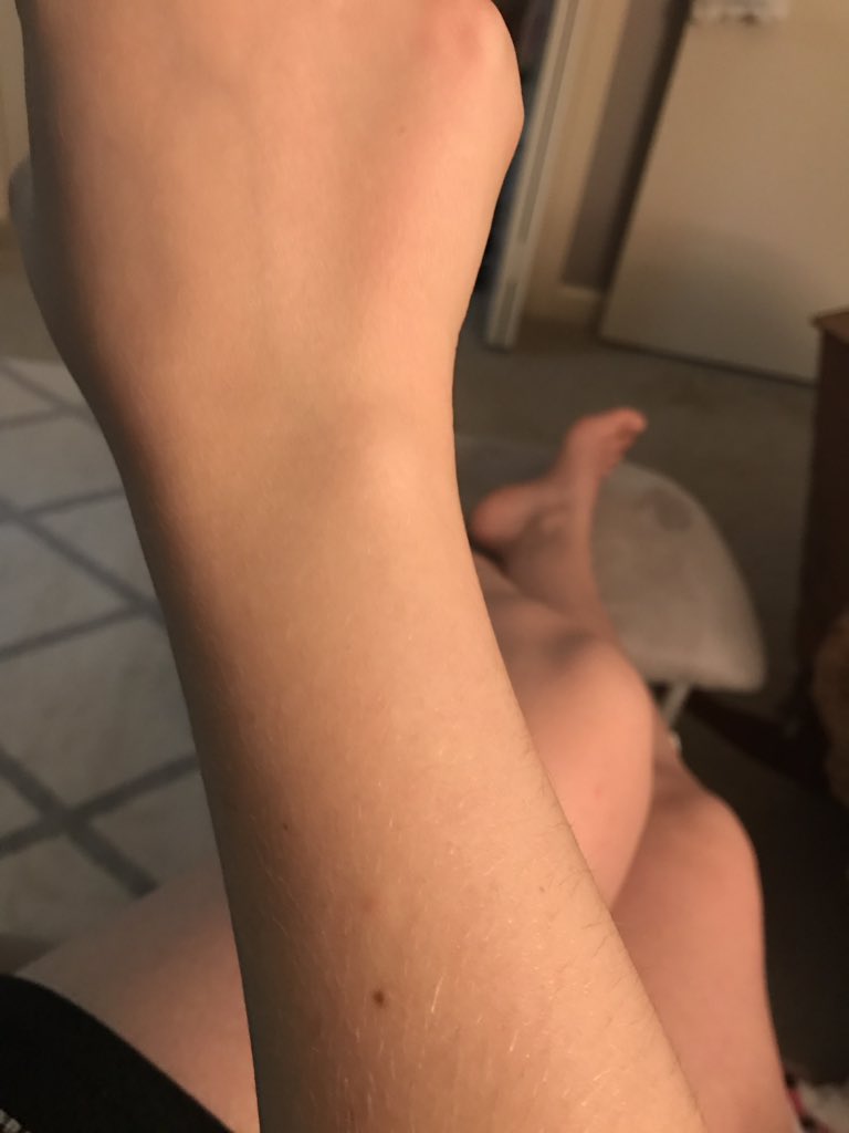 muriel_star's tweet photo. @aarynwhitley Both wrists 👀 https://t.co/VbZhz0FB4v