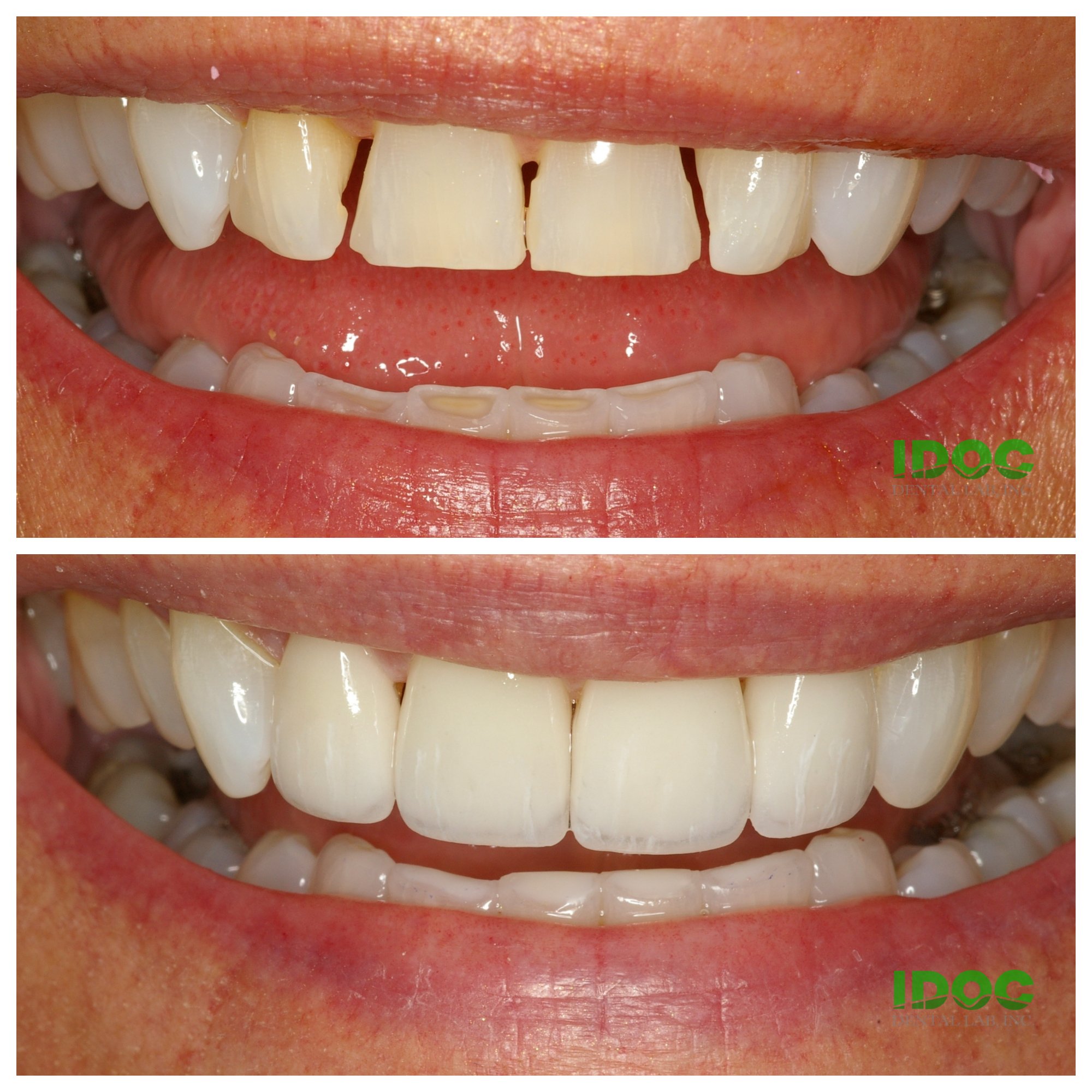 IDOC Dental Lab (IDOCdentalLab) / Twitter