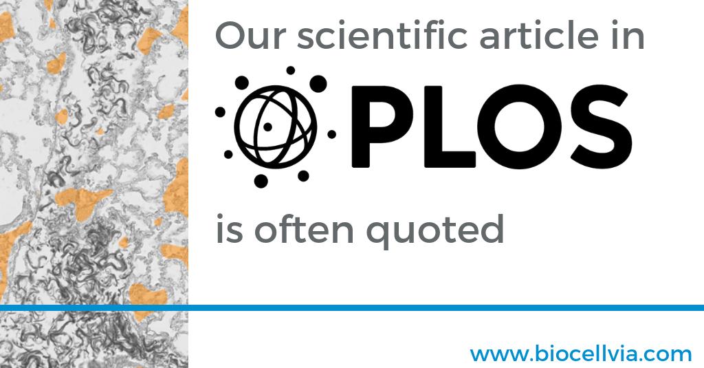 Our article on the digital analysis of Idiopathic Pulmonary Fibrosis (IPF) is often quoted. There has been a significant impact which is yet another sign the scientific community is interested in our technology.
More info on : lnkd.in/gD5CVFS