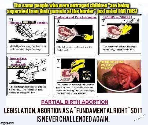FarRightofLeft_'s tweet photo. @HekatEvilBitch @JeffTutorials @EdKrassen @krassenstein @realDonaldTrump That's what you emotional retards always say when you face factual evidence. 
Therefore, nothing really surprises me about their moral bankruptcy.

#FactsMatter #AbortionIsMurder https://t.co/2svLEtjqWh