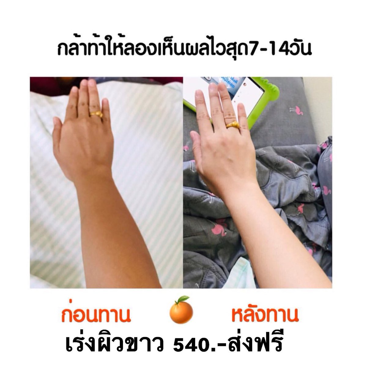 parinda18377655's tweet photo. ✦สูตรเร่งรัดเห็นผลไว 2 เท่า 🍇🍊
#สิวยุบไวมากก #ผิวVาวใสไวสุดดด
เห็นผลลัพธ์ตั้งแต่เซ็ตแรก‼️ #ท้าพิสูจน์
สูตร 2+1 ดีที่สุด 💜🧡
สูตรสะดวกสวย !!!
#Zomrichzu #collplus
💨 #เซ็ตนี้ส่งฟรี EMS #อยากขาว #รีวิววัตสัน #สกินแคร์รักษาสิว #ลดสิว #ฝ้ากระ #howtobeauty #howtopefect https://t.co/56vfr8vrBI