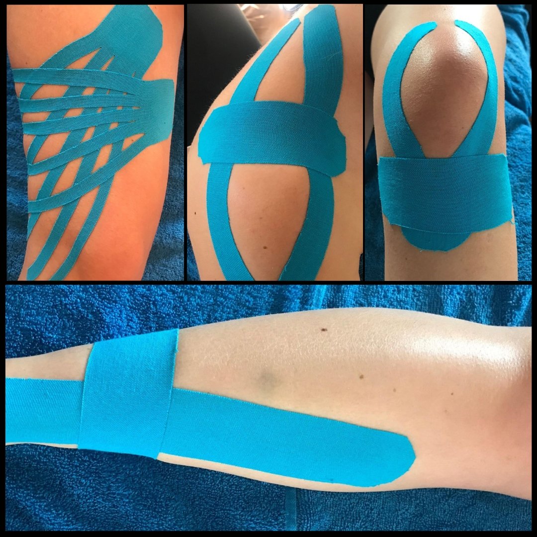 🔥K-TAPING🔥

Here at purity along side our range of massages and physio our masseuse Charlotte also does K-taping.
K-tape can be used for a range of different reasons including;
The reduction in muscle soreness, recently injured tissues and to aid recovery and rehabilitation.