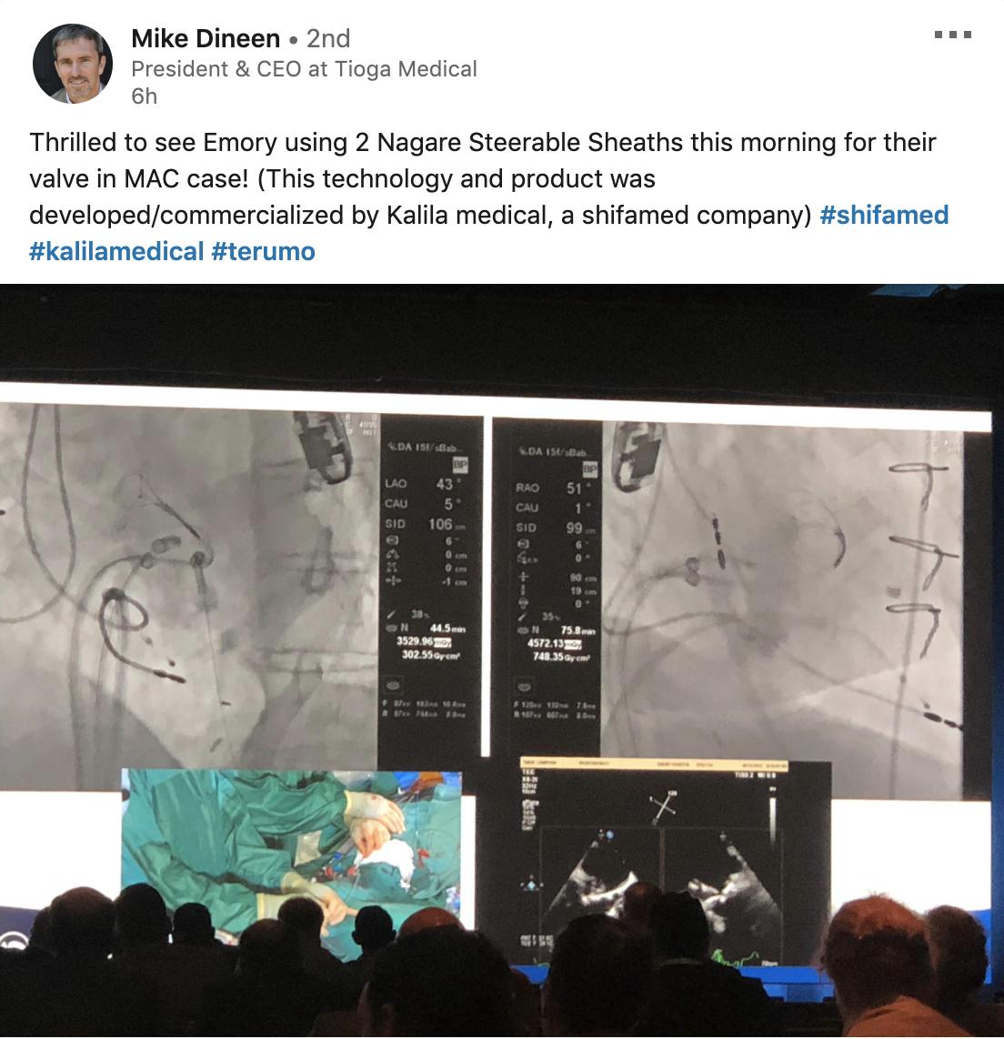 Shifamed (@shifamed) on Twitter photo Always great to see our #innovation at work!
Congratulations to Mike Dineen and the entire Kalila Medical (Abbott Laboratories) Team! #TeamShifamed #Terumo Always great to see our #innovation at work!
Congratulations to Mike Dineen and the entire Kalila Medical (Abbott Laboratories) Team! #TeamShifamed #Terumo