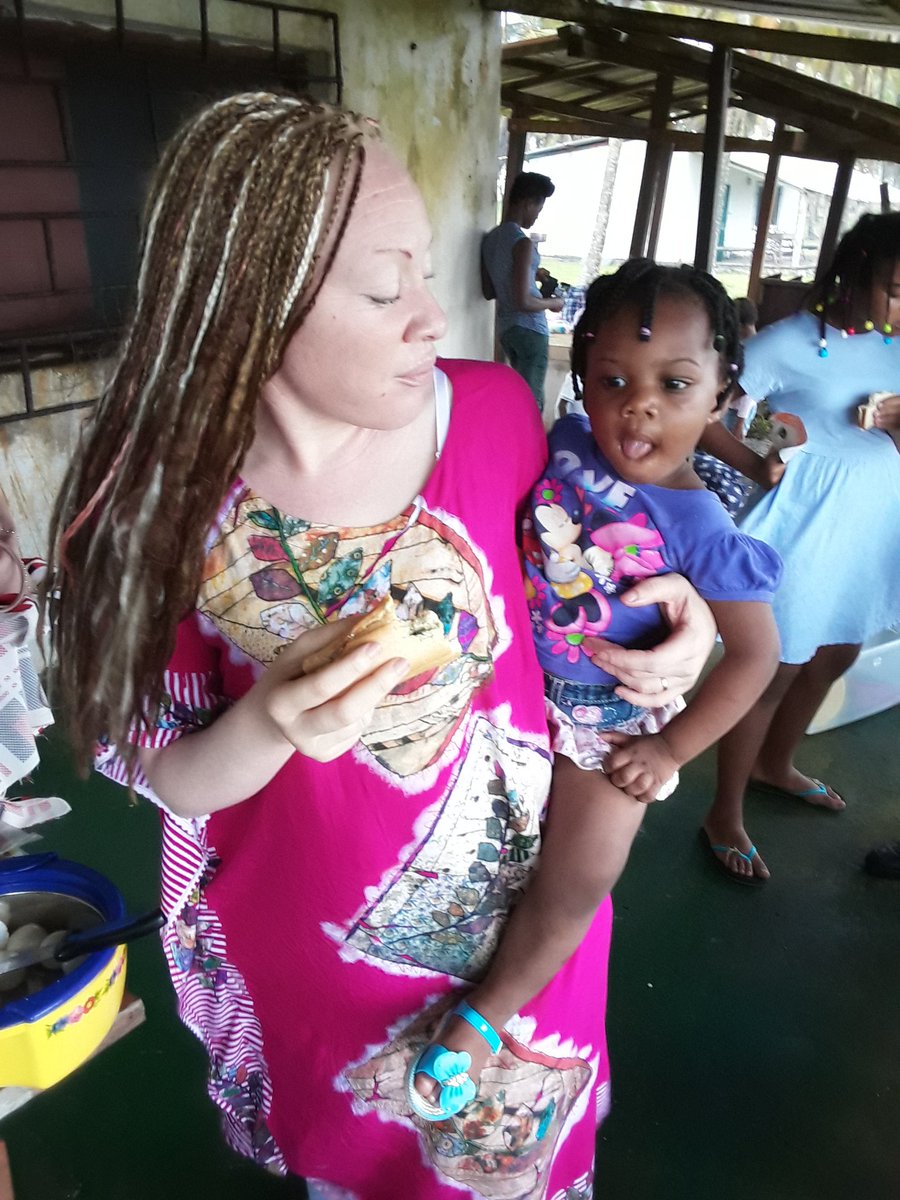 ngoua_ntsame's tweet photo. 13 juin journee internationale de sensibilusation. Nous sommes albinos certes mais avant tout nous sommes humains. Nous meritons respect et consideration.nous avons besoin d etre préservé du soleil qui nous tue.  Pas de magie ni de malédiction juste une vie humaine sans couleur. https://t.co/7waReSFSMN