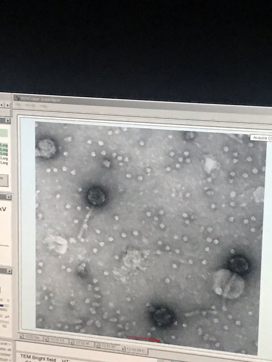 Found both phages using the electron microscope at UAMS. Magnified only 80,000X 😂 <a href="/UOzarks/">Univ. of the Ozarks</a> <a href="/phagesdb/">phagesdb</a>