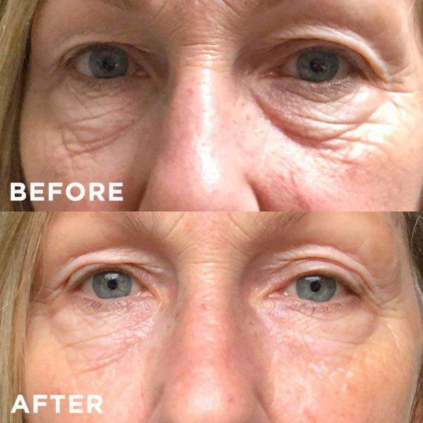 modere cellproof eye cream