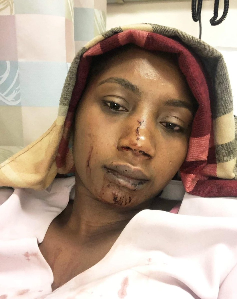 _SJPeace_'s tweet photo. 22 y/o Black Muslim woman was brutality beaten &amp; robbed in NYC by a group of teens who shouted Islamophobic &amp; racial slurs at her. The NYPD failed to investigate &amp; dismissed the case. 

She investigated her own hate crime &amp; the NYPD was forced to reopen it

Camara is a Hero! https://t.co/cUEzlqB1FT