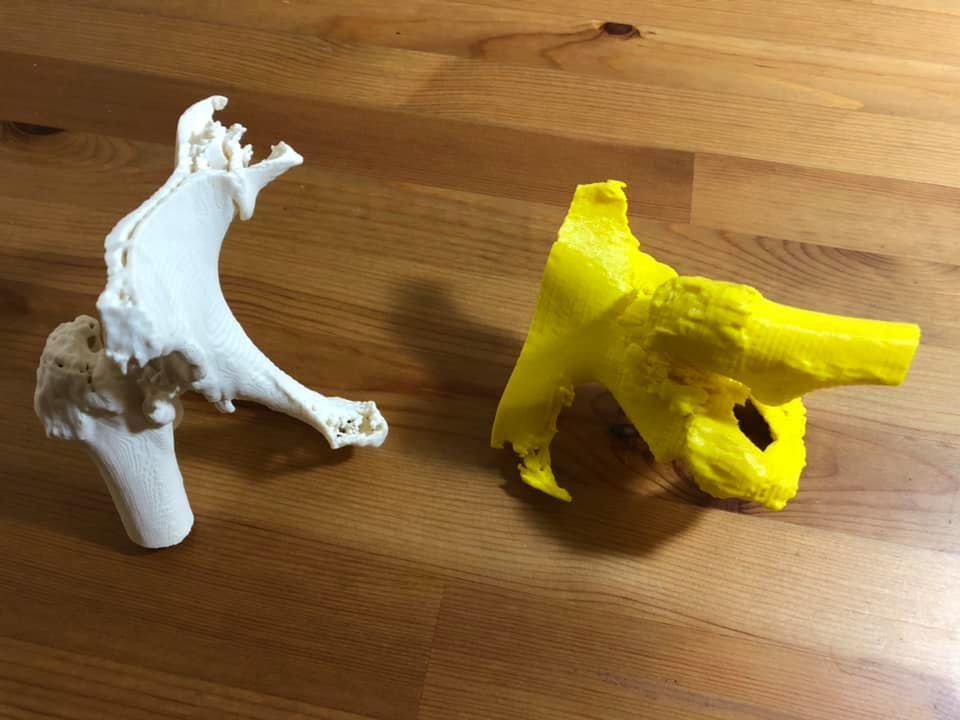 DrDanielWiznia's tweet photo. A Yale medical student at the @YaleCEID helped me 3D print these pelvic models for a complex hip replacement. I can visualize how my implants will fit within the unique shapes of this patient’s deformity. @YaleOrtho @yaleseas @Yale @YaleMed #3Dprinting, #engineering, #ortho https://t.co/Su5wqULCZw