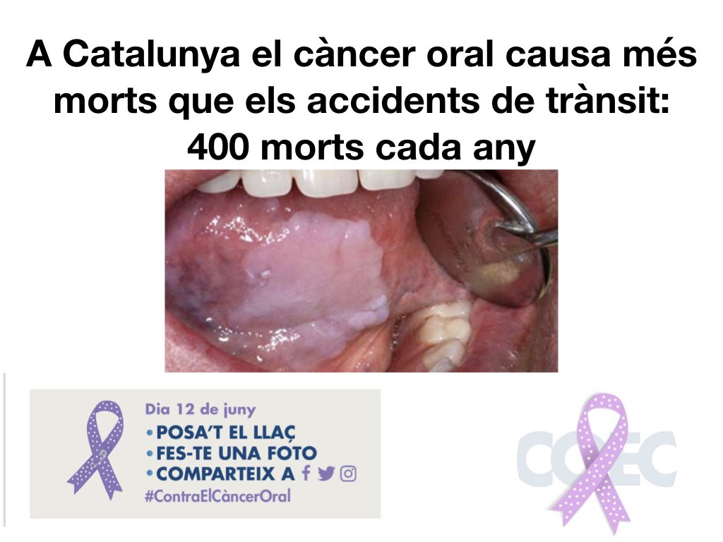 tonigomezj's tweet photo. BRUTAL OI?  @jordibaste @SilviaCoppulo @jordievole @ElisendaCamps1 @JosepCuni @soler_toni @ristomejide   ens ajudeu a sensibilitzar a la població? #ContraElCàncerOral https://t.co/rDRDS2ZmMb