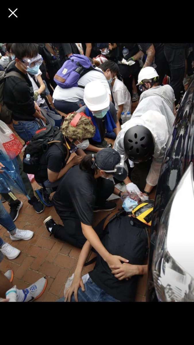 C1cLe_YuEn's tweet photo. [16:15]
A protester’s head was bounced by rubber bullet https://t.co/WHaNpTmecc