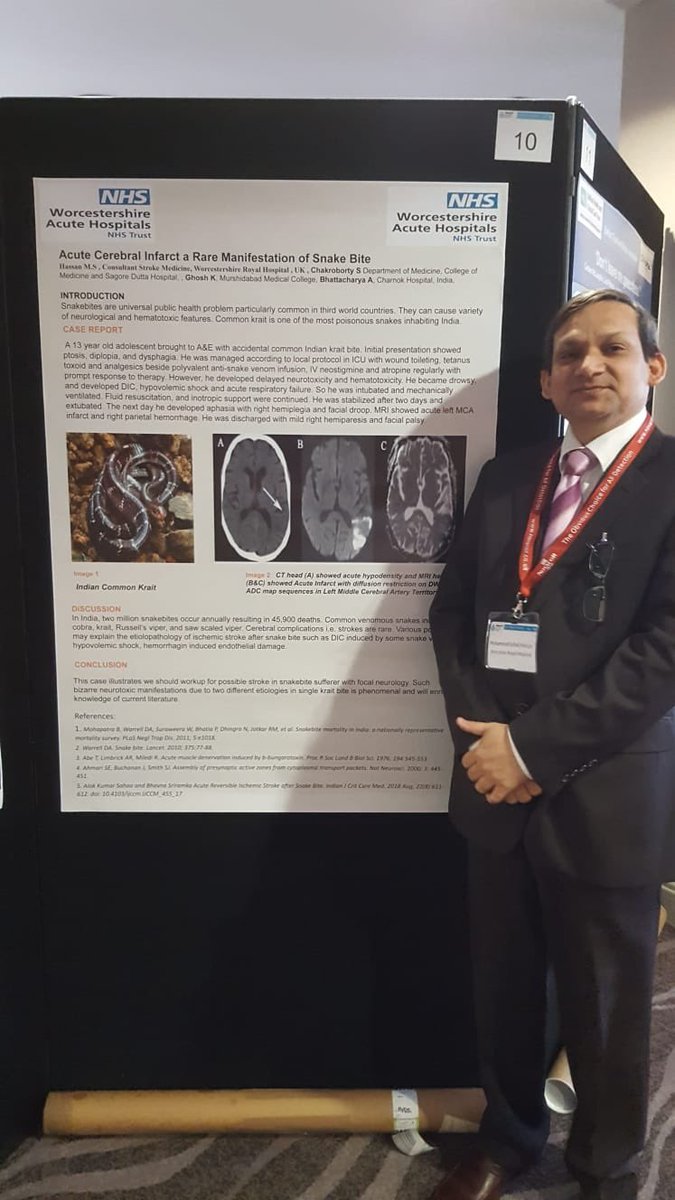 Congratulations to Dr Hassan who presented his poster at the Northern Ireland Stroke Conference. #sharingpractice #stroke #youngstroke @WAHT_OT @DavidNichols0n @BrendanYoung3 @WAHT_Physio @M_J_Hopkins