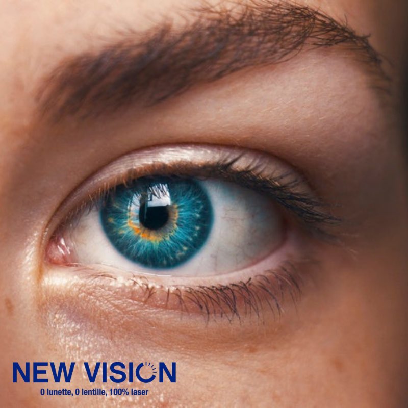 ClinicNewVision's tweet photo. En France, 46% des 20-29 ans présentent des troubles de la vision. De plus en plus de jeunes développent une myopie à cause de l'utilisation abusive des écrans et du manque de lumière naturelle. 

Mais qu'est-ce que la myopie exactement ? Plus d'infos : https://t.co/TgZXQT66KU https://t.co/68AewtOk6n