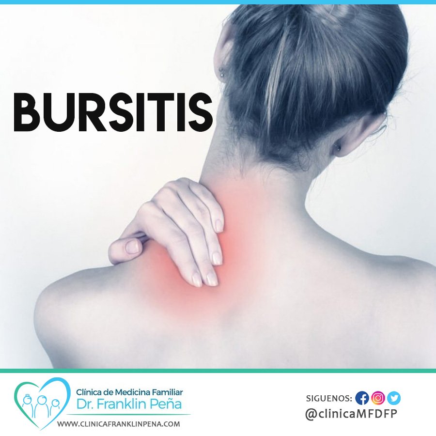 clinicaMFDFP's tweet photo. La bursitis es un trastorno doloroso que afecta las pequeñas bolsas rellenas de líquido (bolsas sinoviales) que proporcionan amortiguación a los huesos, tendones y músculos alrededor de las articulaciones. 
#TuSaludLoPrimero #Bursitis #Sintomas https://t.co/jcn6Wm5Y9I