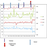 CRMjournal's tweet photo. Recently Accepted: Inadequacy of #Pulseoximetry in the #Catheterizationlab. An #Exploratorystudy Monitoring Respiratory Status Using #Arterialblood Gases during #Cardiaccatheterization with Conscious Sedation
@ZaherFanari et al
https://t.co/7VgTwuABFq https://t.co/mUqqNJIl19